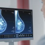 IA câncer mama em startups de saúde apoiadas pela NVIDIA